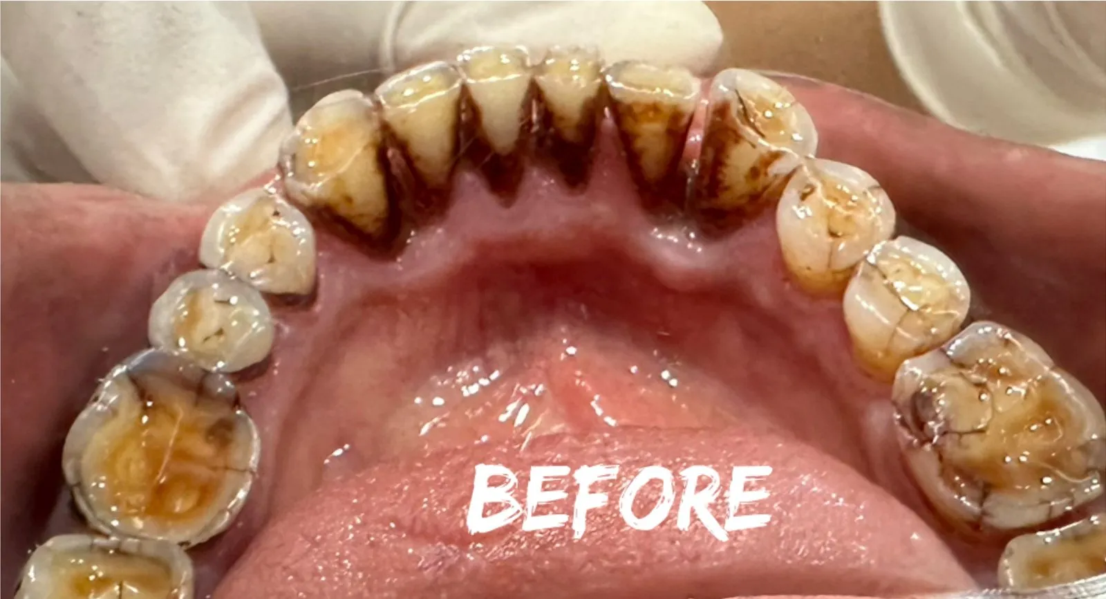 Before: Front view, Case 3 · Check-ups & Cleaning